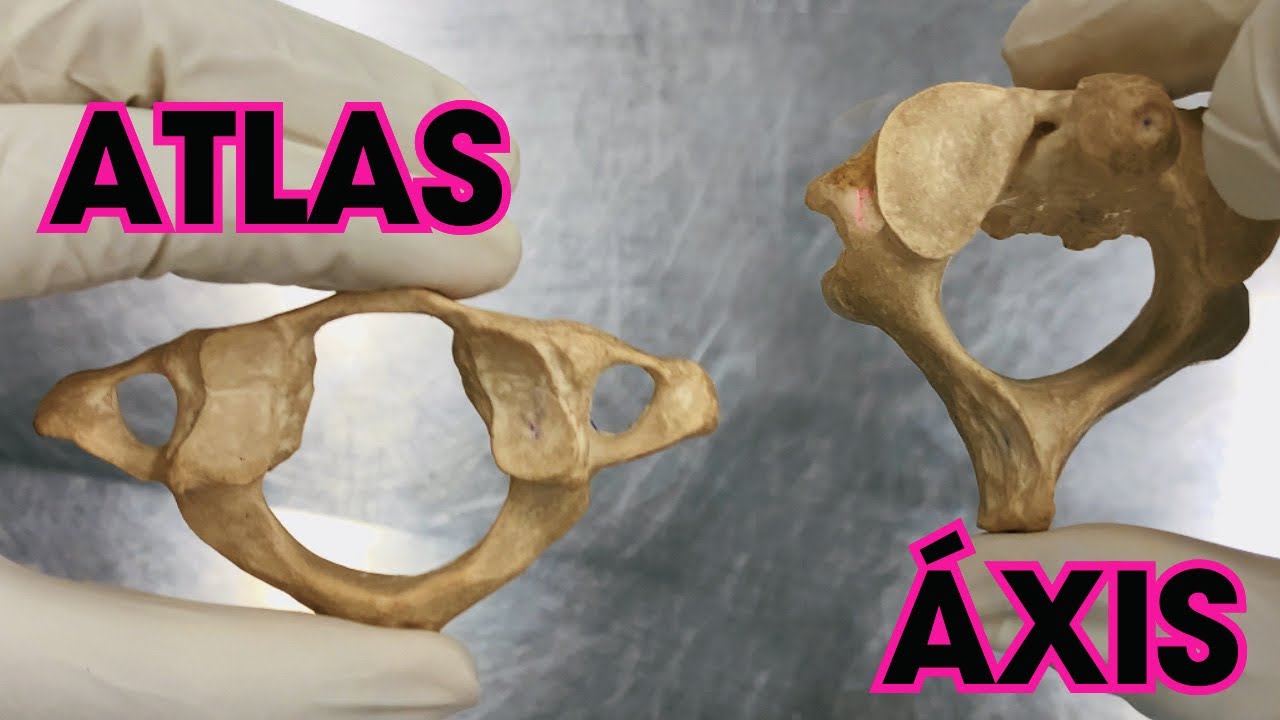 VÉRTEBRAS ATLAS E ÁXIS + QUIZ