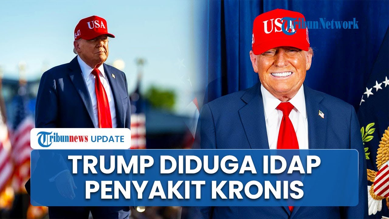 Potret Donald Trump Idap Penyakit Kronis, Tutupi Tangan Memar Pakai Makeup, Ini Kata Gedung Putih