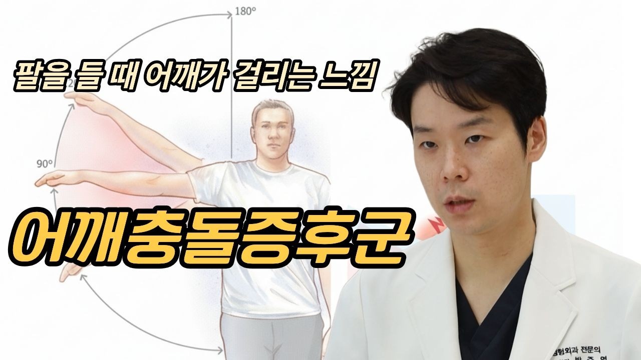 팔을 들 때 어깨가 걸리는 느낌, 어깨충돌증후군