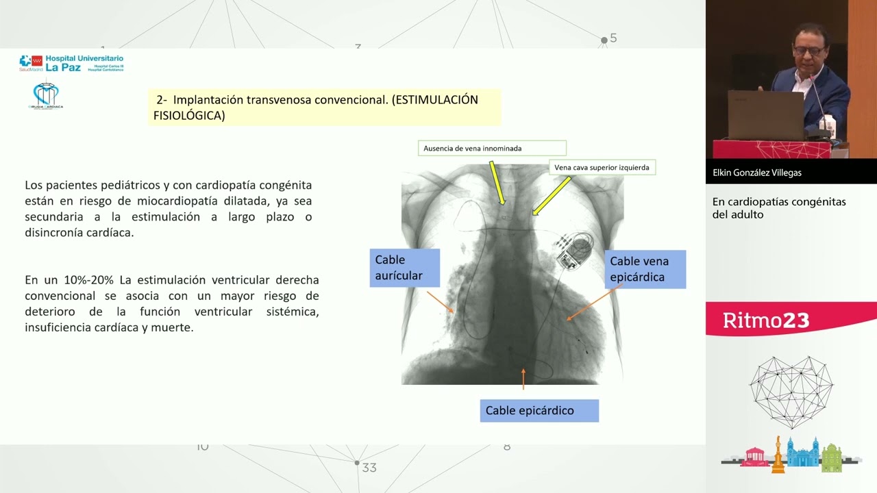 Estimulación cardiaca en situaciones especiales