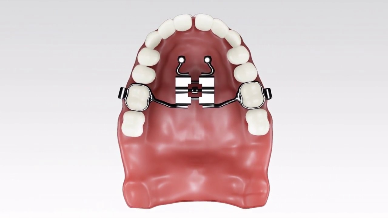 PSM BENEfit Hybrid Hyrax 180502