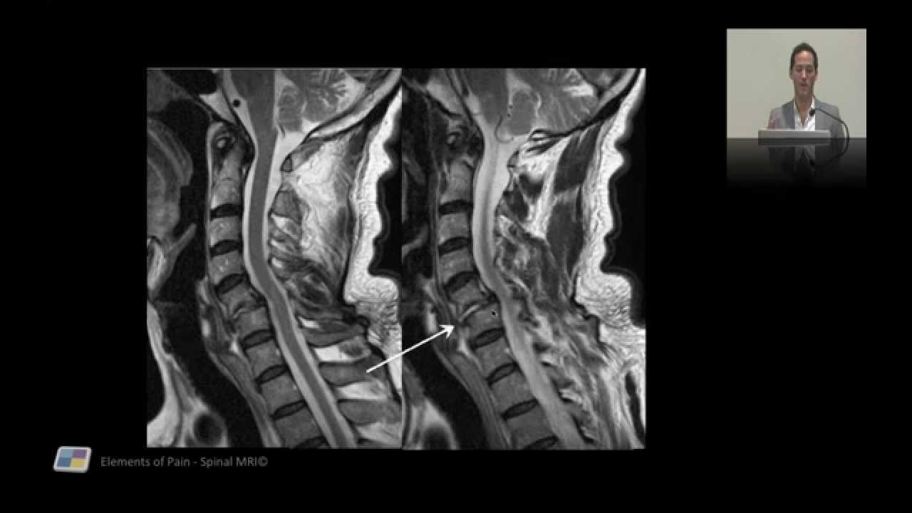 22. Interpreting MRIs