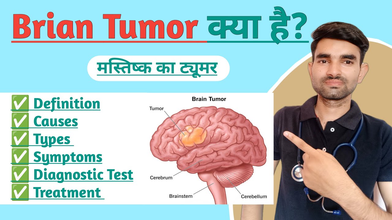 Brain Tumor in Hindi | Causes, Types, Symptoms And Treatment of Brain Tumor
