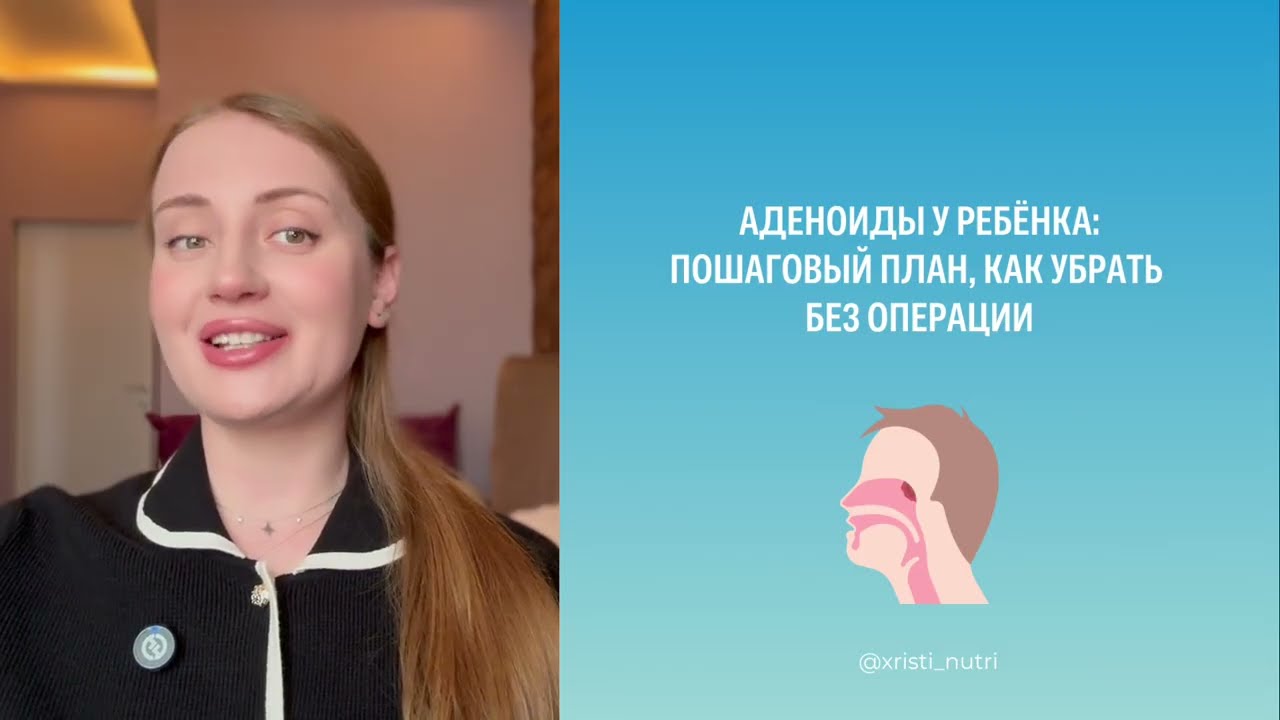 Аденоиды у ребёнка: пошаговый план, как убрать без операции