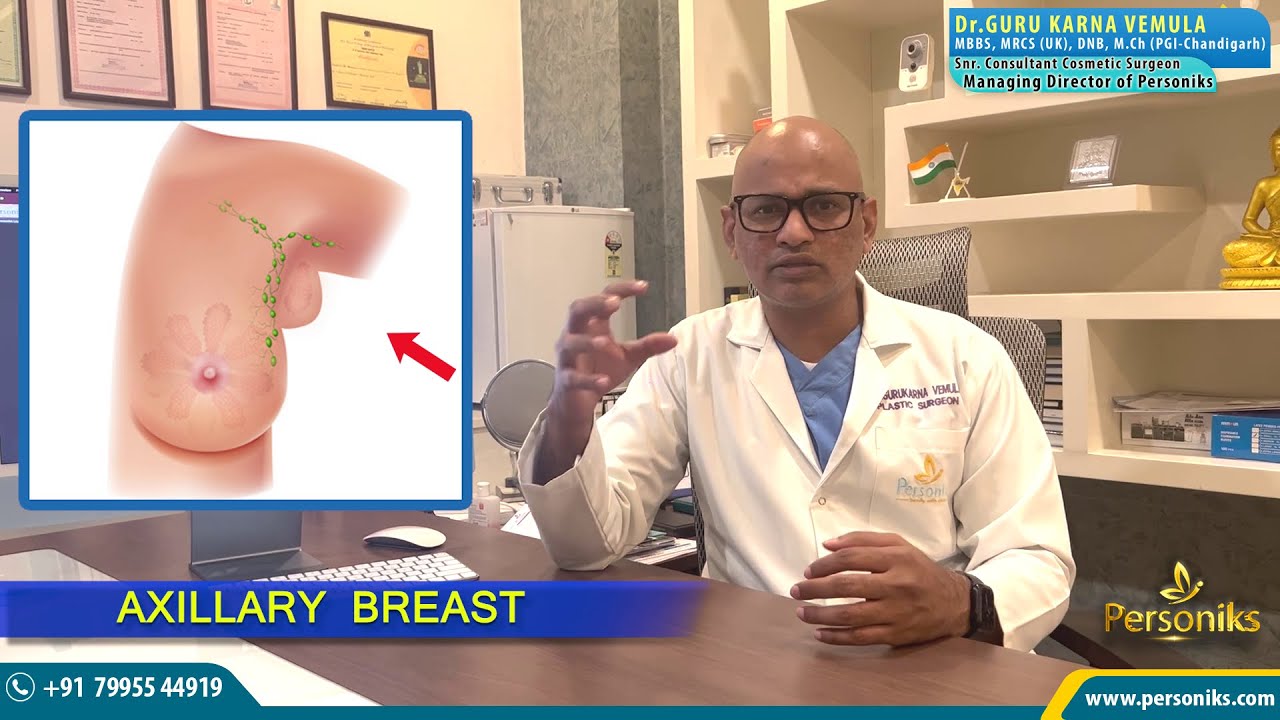 Axillary Breast tissue removal surgery @  Personiks Hyderabad | Dr.Gurukarna Vemula
