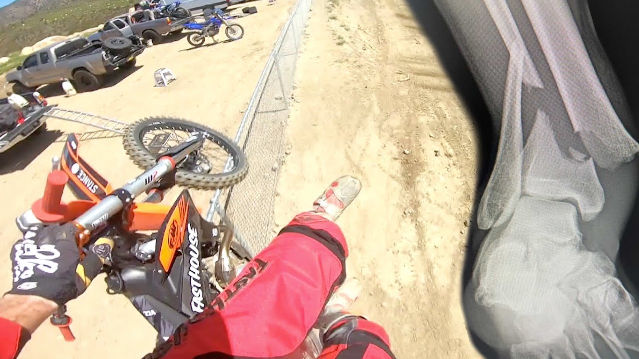 INSANE DIRTBIKE CRASH!! CAUGHT ON GOPRO