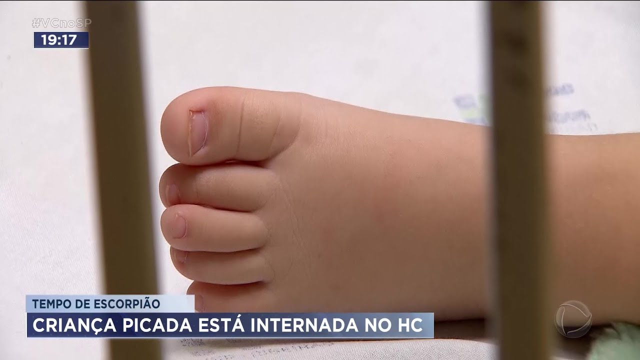 Bebê de 1 ano é internado após ser picado por escorpião em Ribeirão Preto
