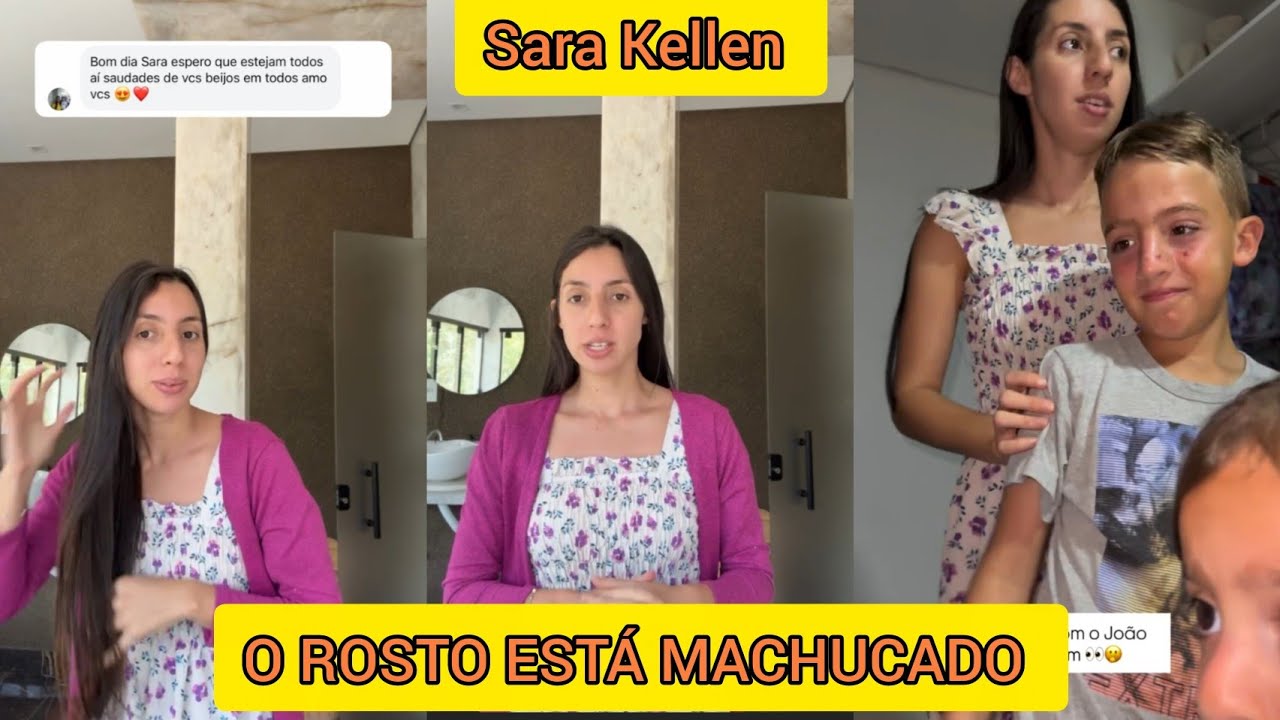 SARA KELLEN MOSTROU COMO ESTÁ O ROSTO DO JOÃO