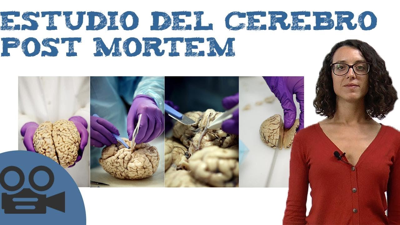 Estudio del cerebro post mortem