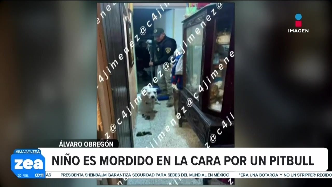Menor es atacado en el rostro por un perro pitbull | Noticias con Francisco Zea