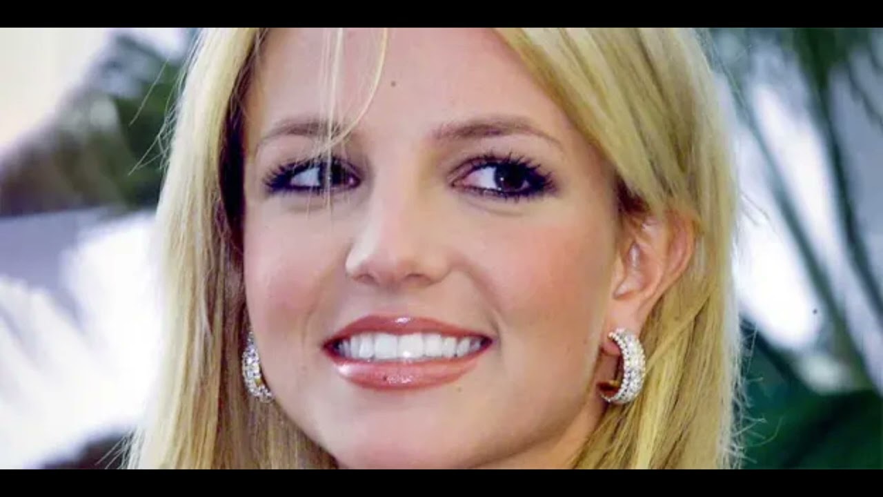 What Happened to Britney Spears Teeth? Why are they Separating?🤔😳