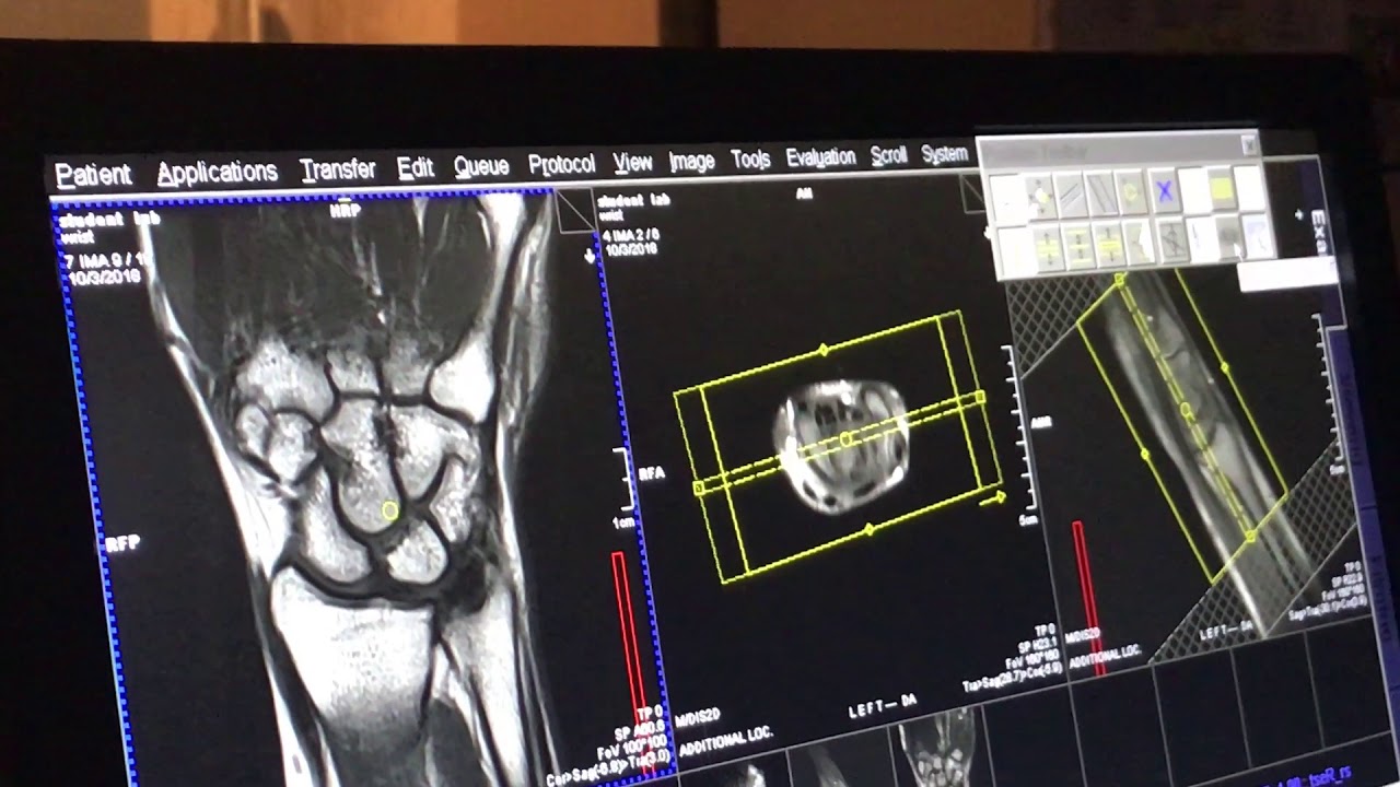 School of Medical Imaging MRI Lab Wrist - Coronal and Adjust Volume