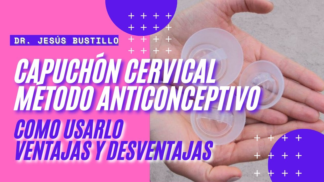 CAPUCHÓN CERVICAL método anticonceptivo, ventajas y desventajas