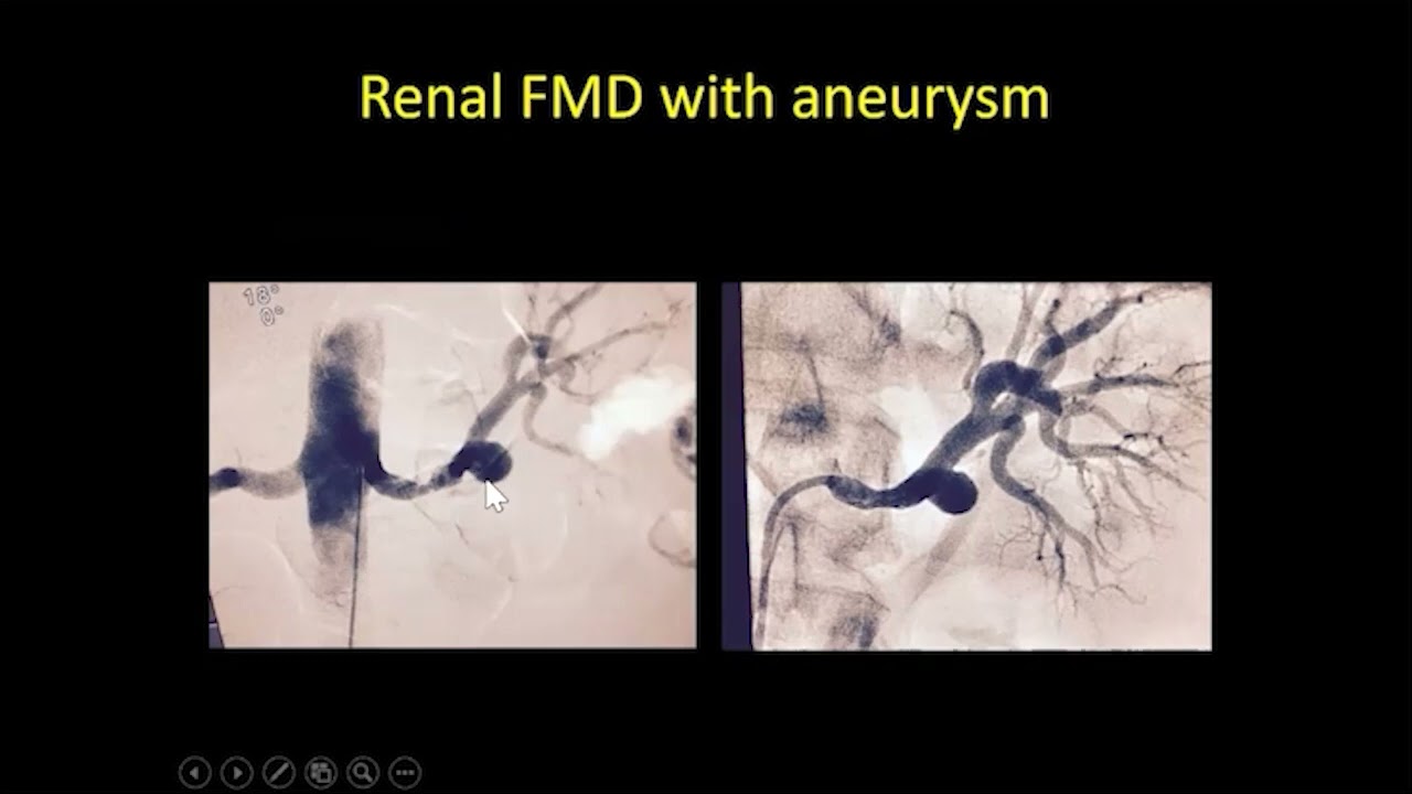FMD SCAD 2024 02 Wells FMD Treatment
