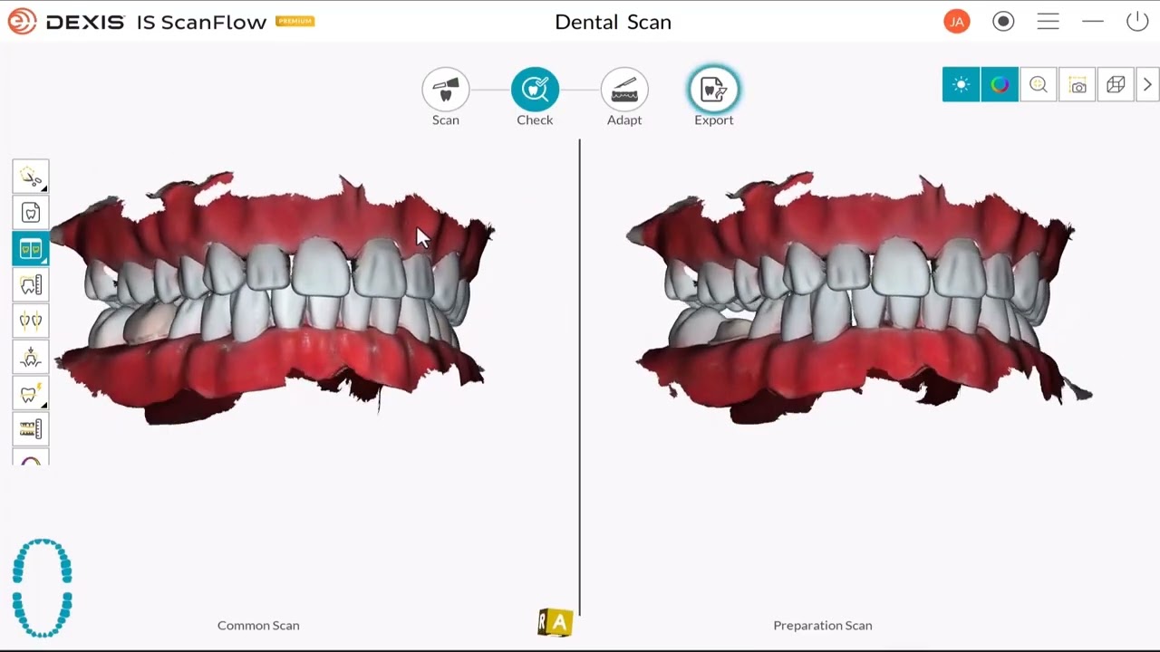 DEXIS IS ScanFlow   Preparation Scan Workflow