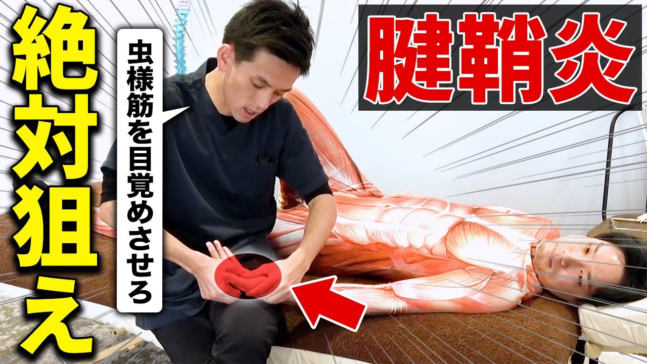 【※全治療家見て】MP関節が曲がらないから腱鞘炎になる!?㊙治療テクニックを徹底解説！