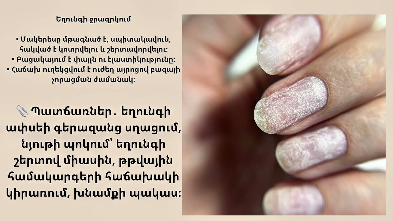 Նախաայրվացքային եղունգներ | օնլայն դաս մատնահարդարների համար