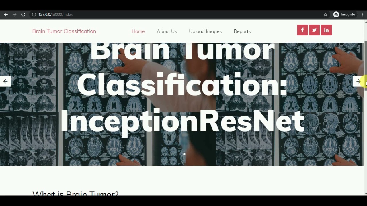 Brain Tumor Classification using Deep Learning | Brain MRI Scan | Model: Inception Resnet V2