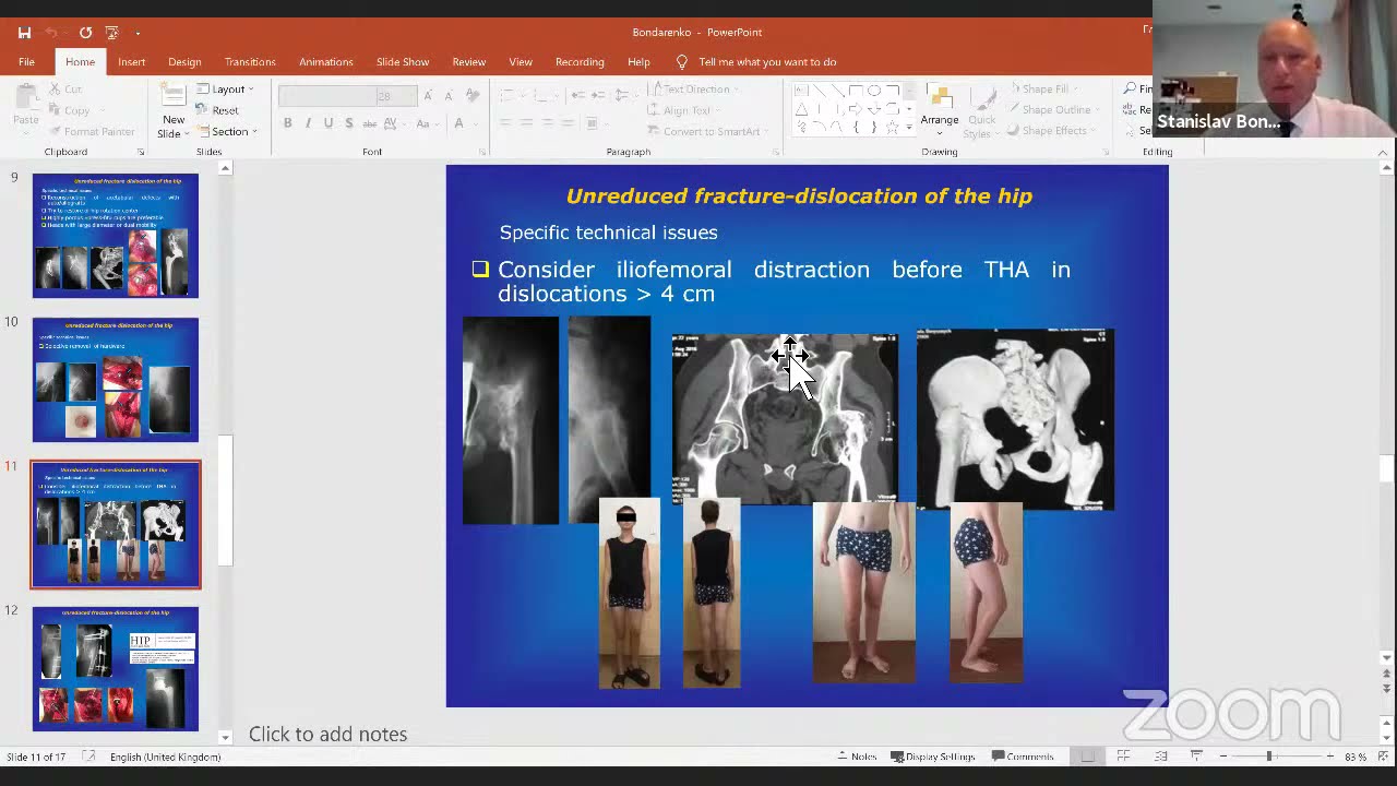 Secretary-General, European Hip Society