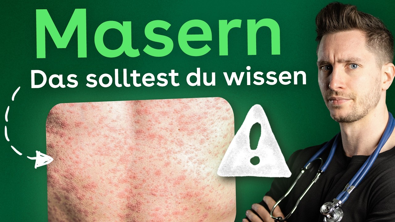 Masern: Warum die F&auml;lle wieder steigen