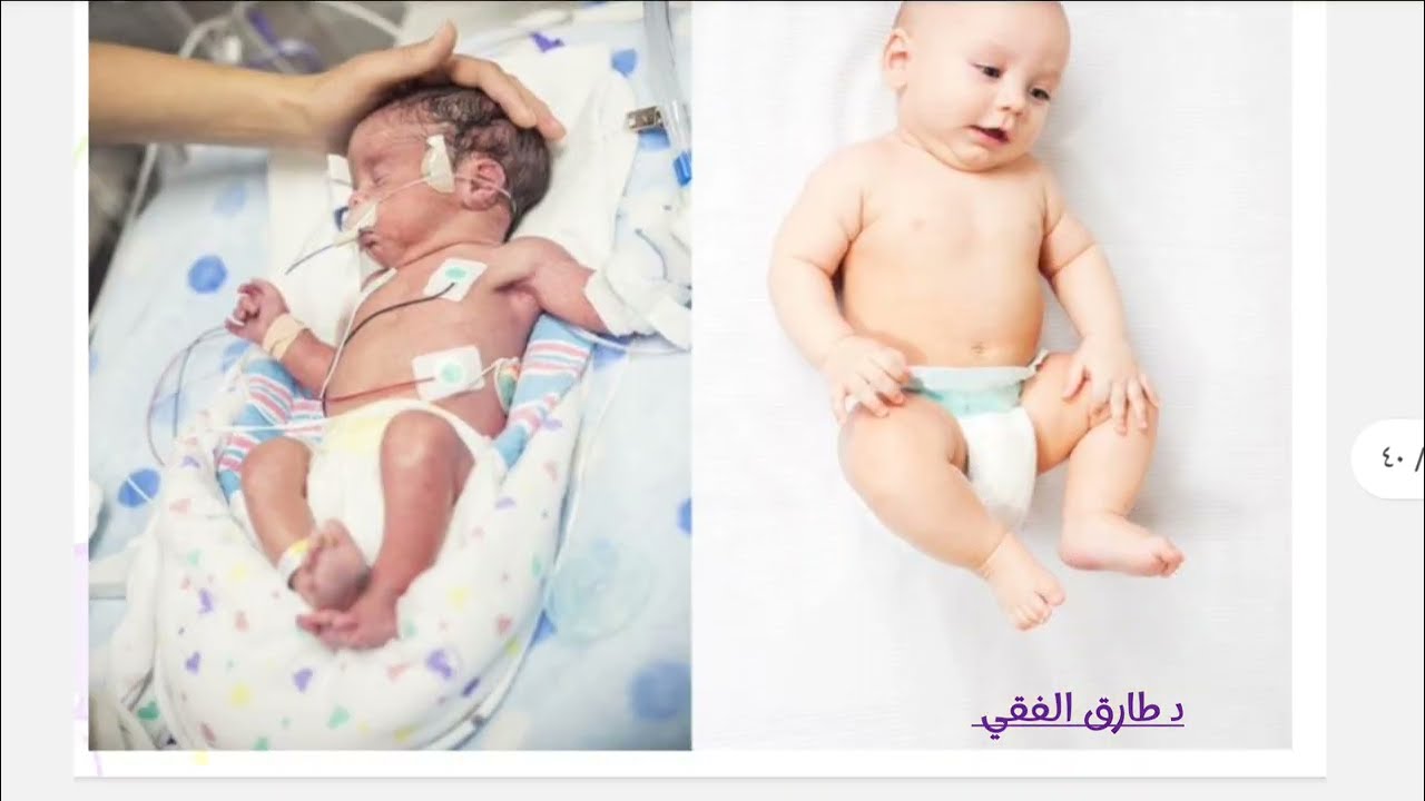 Inside the NICU: How We Care for High-Risk Newborns @DrTarek.Pediatrician | Dr Tarek Elfiky