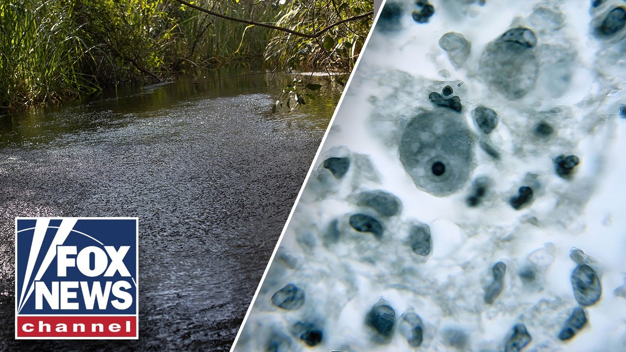 Амёба, пожирающая мозг: один ребенок погиб, подросток в критическом состоянии