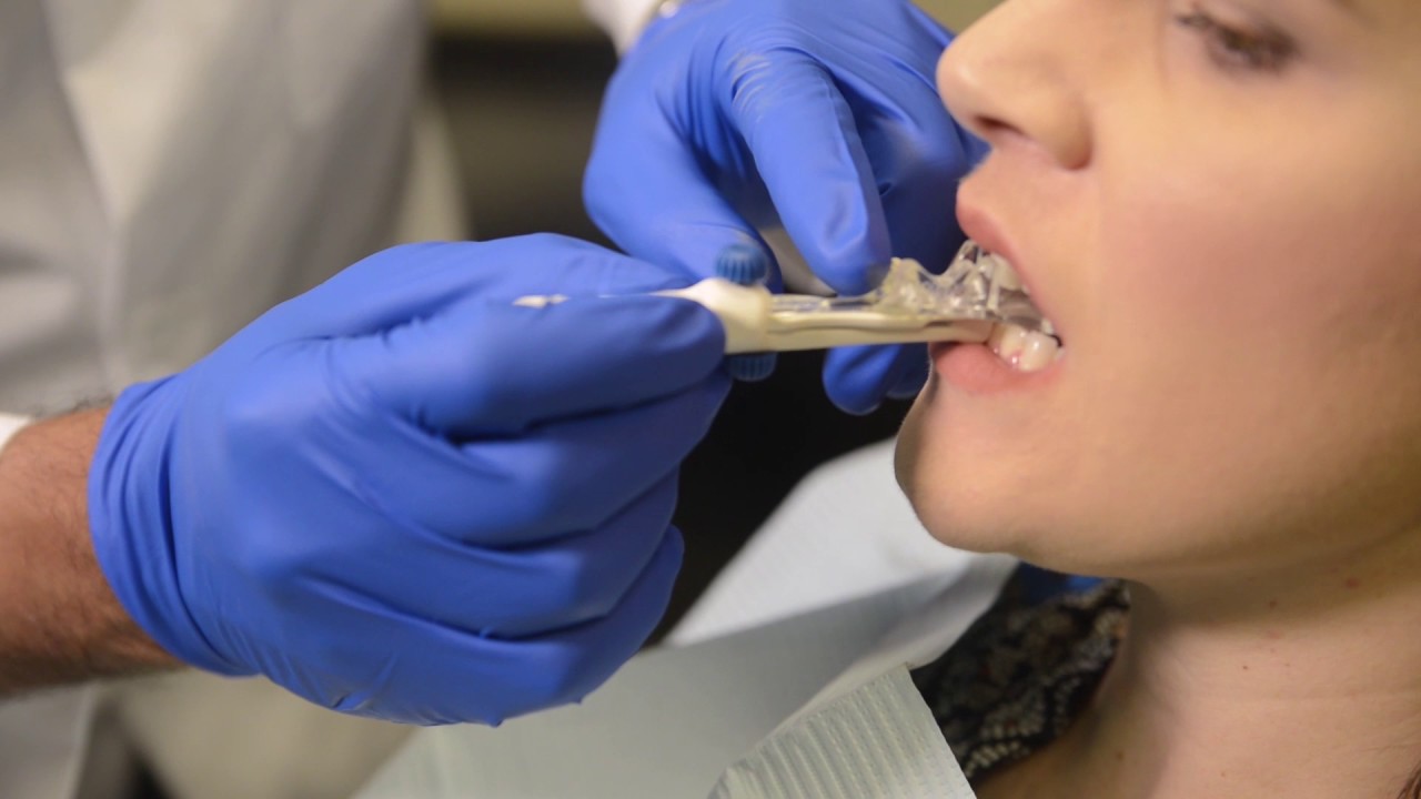 SOMGauge Bite Registration Video