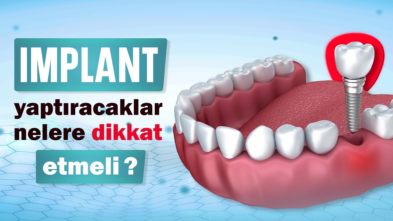 İmplant yaptıracaklar nelere dikkat etmeli?