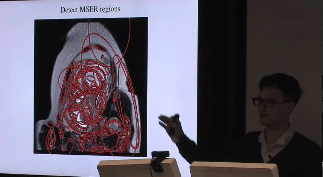 Kevin Keraudren: Localising organs of the fetus in MRI data using Python