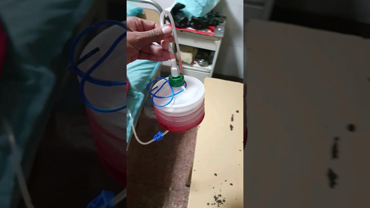 Close Wound Drainage System | Romovac (shown in this video) #tcml