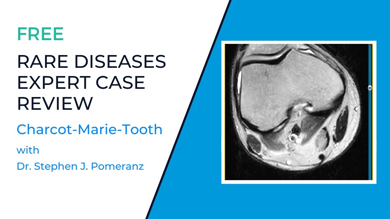 Rare Diseases Expert Case Review (Rare MSK Diagnosis): Charcot-Marie-Tooth