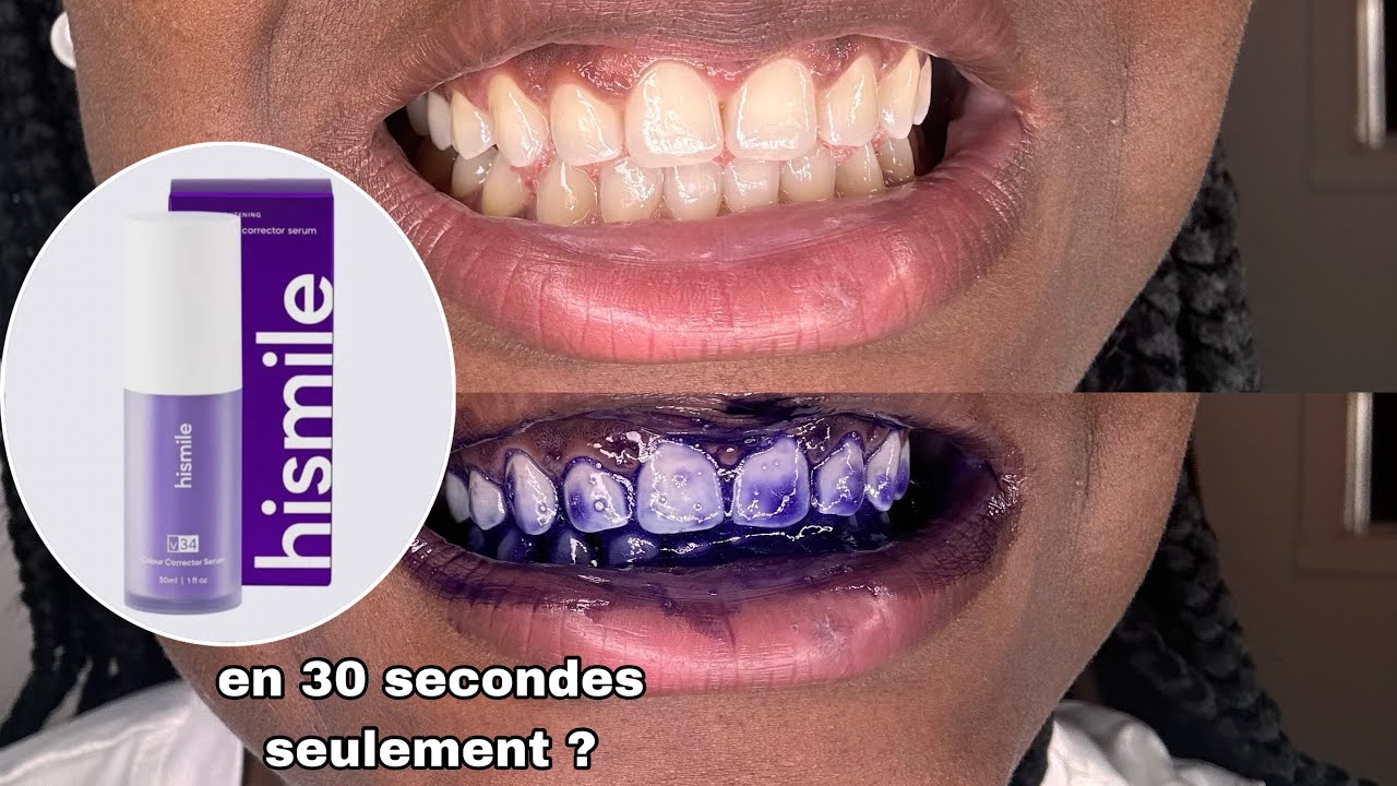 Est ce que le produit «HiSmile V34» rend réellement les dents+ blanche à la première utilisation? 🤔