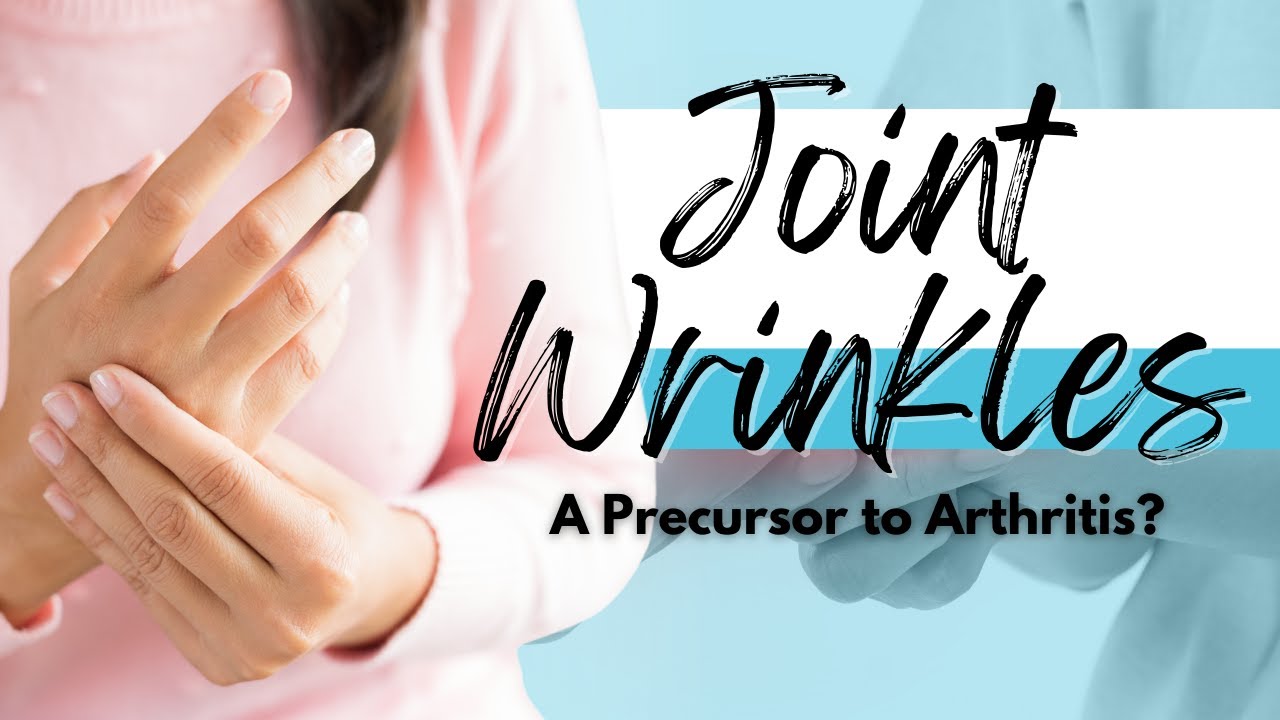 Joint Wrinkles: A Precursor to Arthritis?