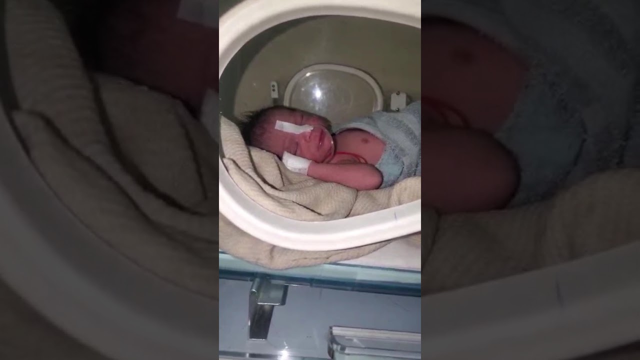 New Born Baby Birth just 1 Hour ago,Now Admit in NICU For More Treatments😍😍