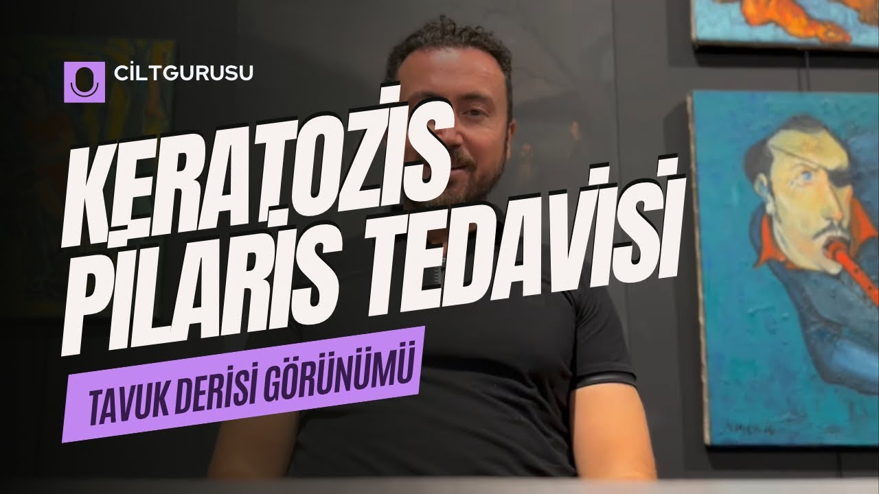 Keratozis Pilaris (Tavuk Derisi G&ouml;r&uuml;n&uuml;m&uuml;) Tedavisi