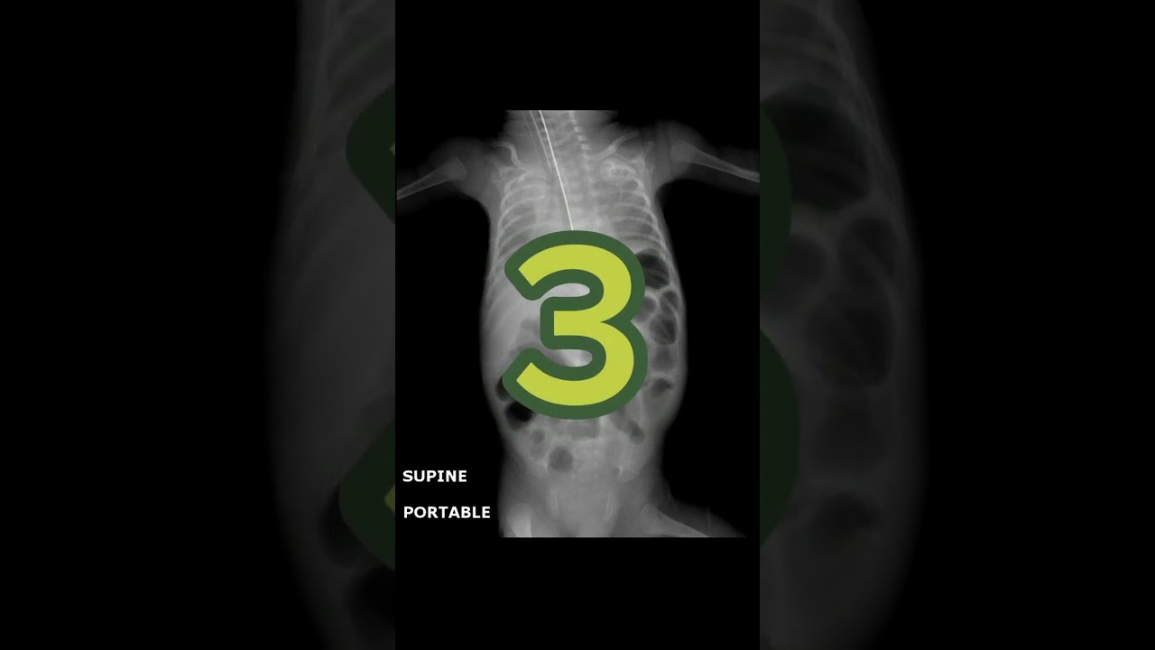 what is your diagnosis?