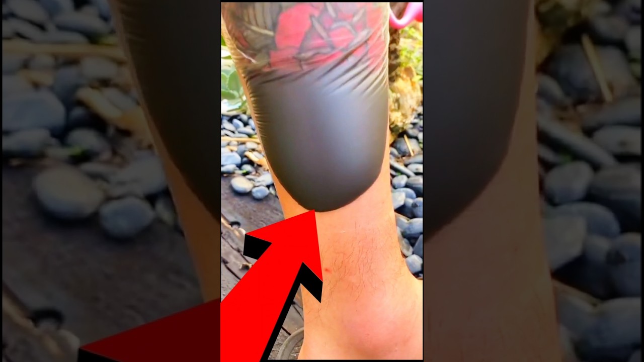 Perch&eacute; il Tatuaggio fa Quella Bolla? 🤔 #shorts #perte