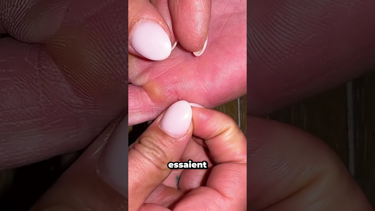 La meilleure astuce pour enlever les &eacute;pines de cactus !
