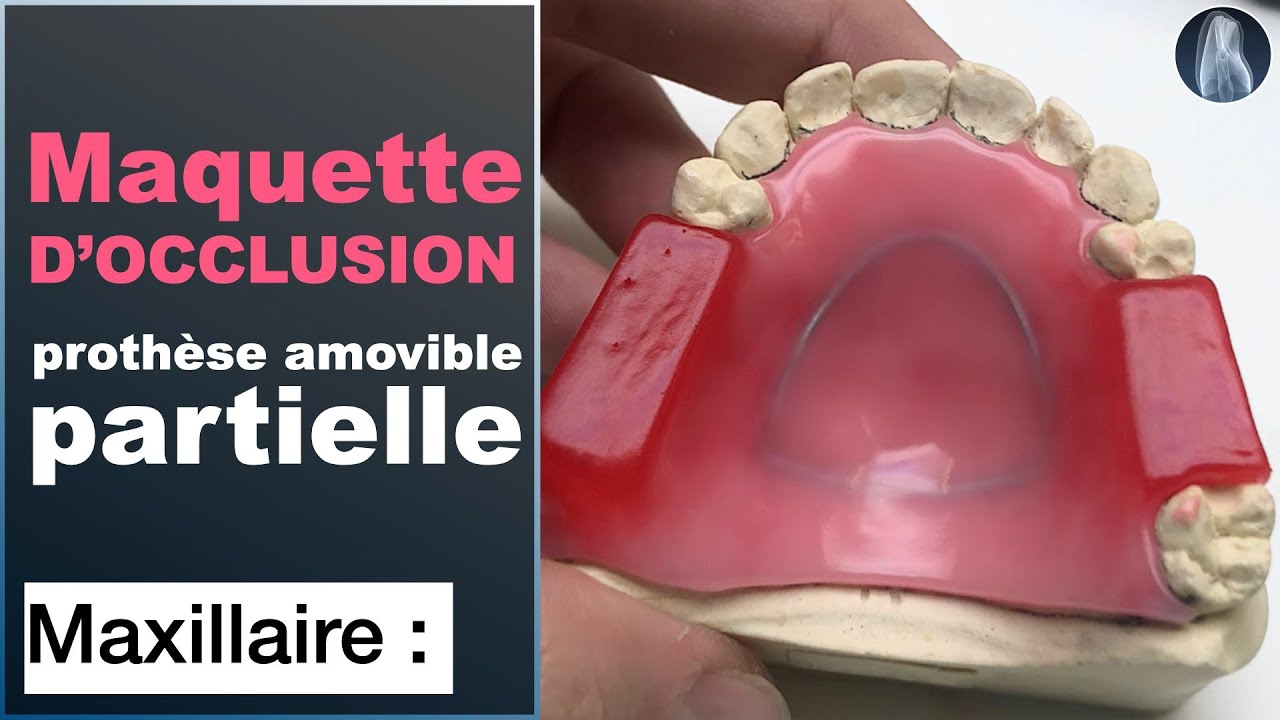 Fabriquez une Maquette d’occlusion pour Prothèse Amovible Partielle - Guide Complet Étape par Étape