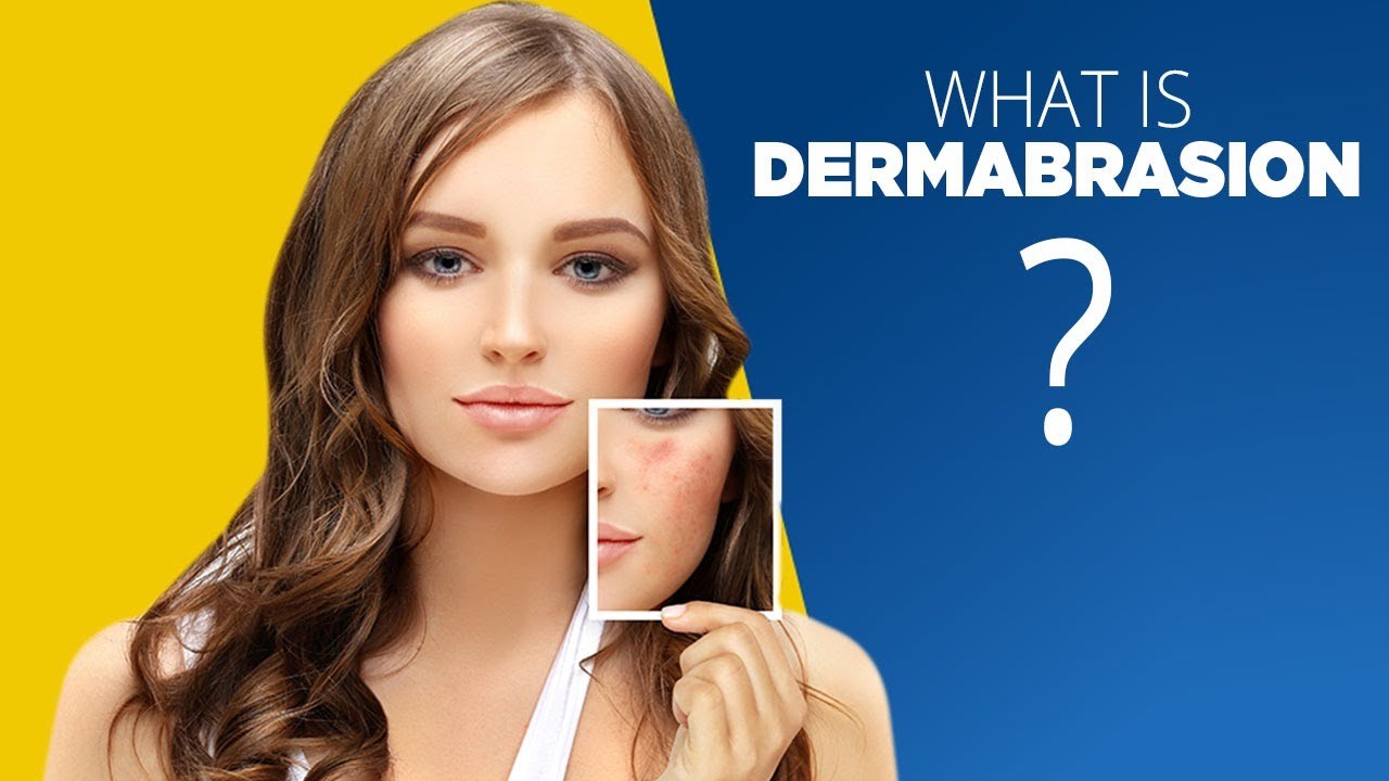 What is Dermabrasion good for | Side Effects and More