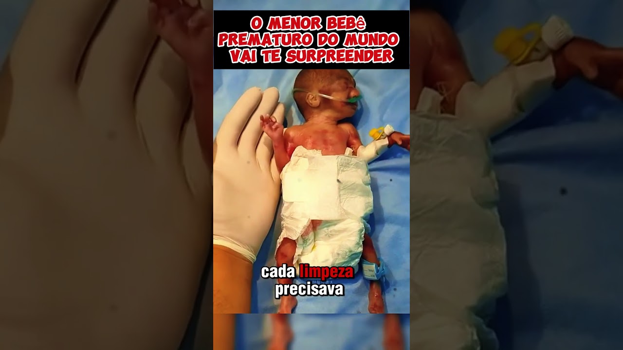 O menor beb&ecirc; prematuro do mundo vai te surpreender #incrivel #curiosidades