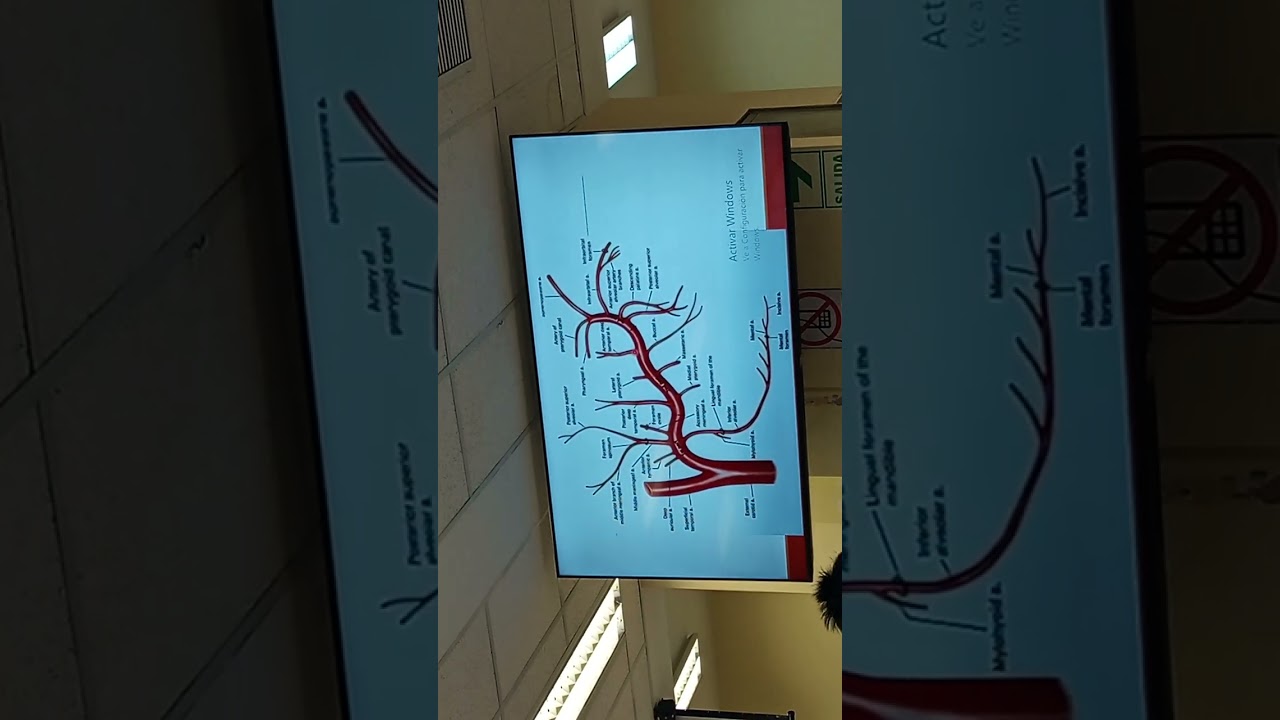Expo anfi; irrigación cabeza, anatomía del ojo
