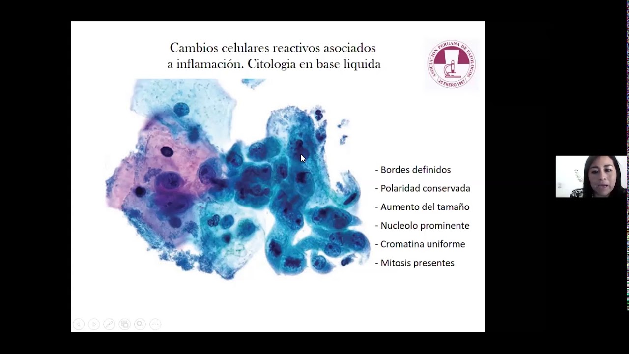 CITOLOGÍA CERVICOVAGINAL PARTE 1