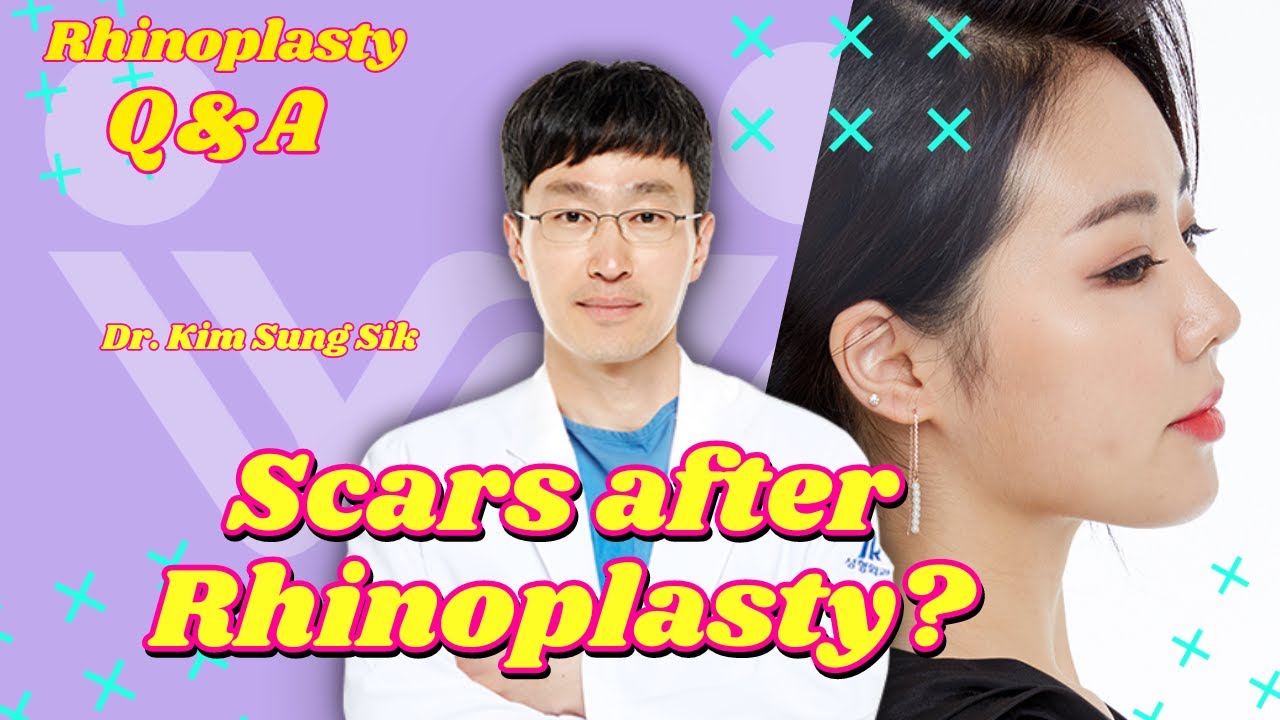 SCARS AFTER RHINOPLASTY? | Rhinoplasty Q&A | Dr. Kim Sung Sik