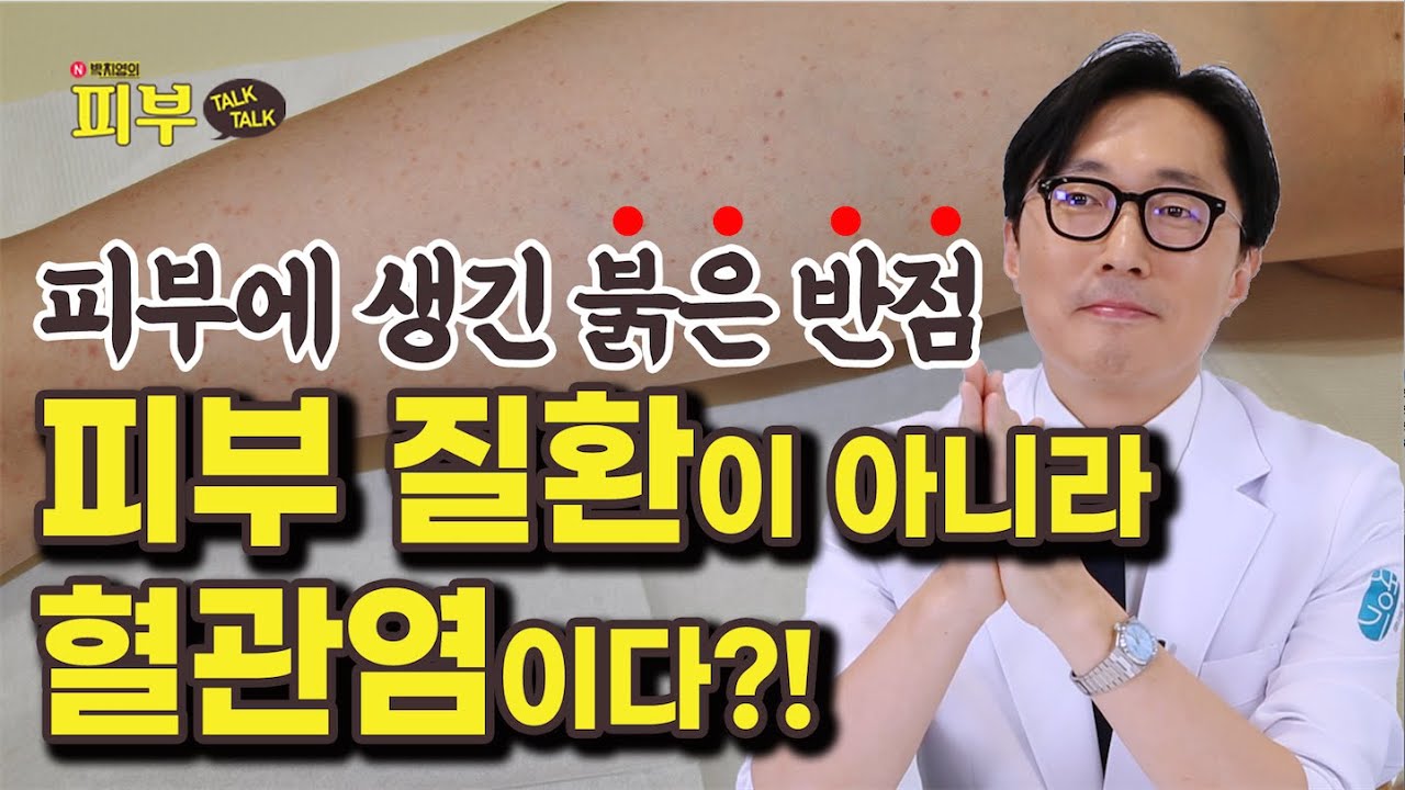 피부에 붉은 반점이 생기는 자반증, &lsquo;이렇게&rsquo; 관리하셔야 합니다 - 박치영의 피부 톡톡 #142