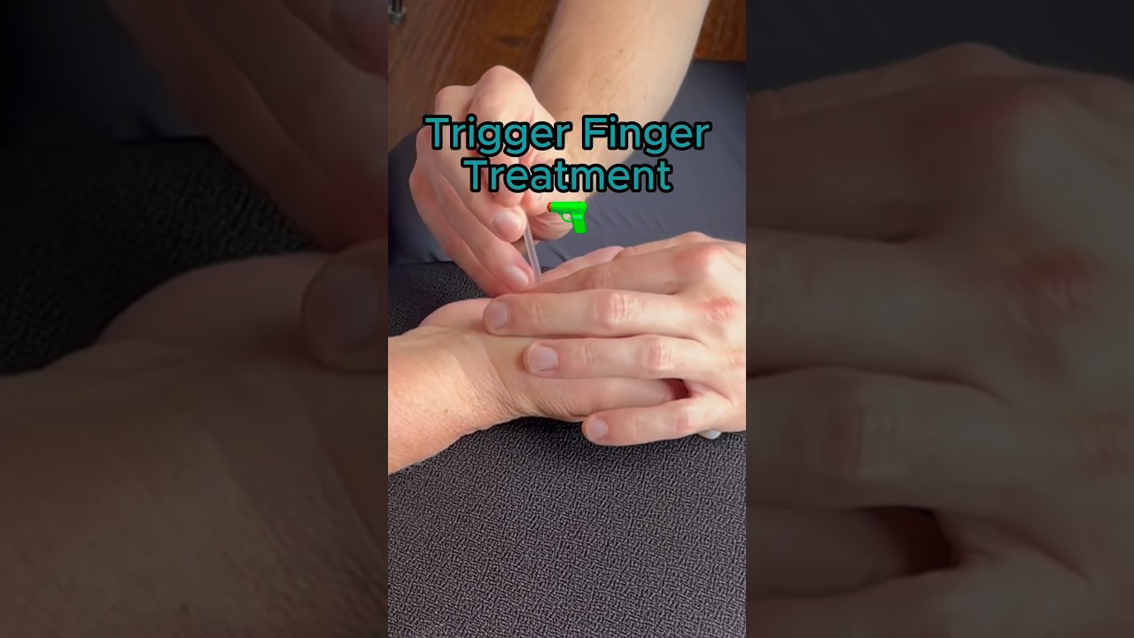 Trigger Finger RELIEF👆🏼🔫 #chiropractor#backpain#neckpain#headaches#nashville #nashvilletn