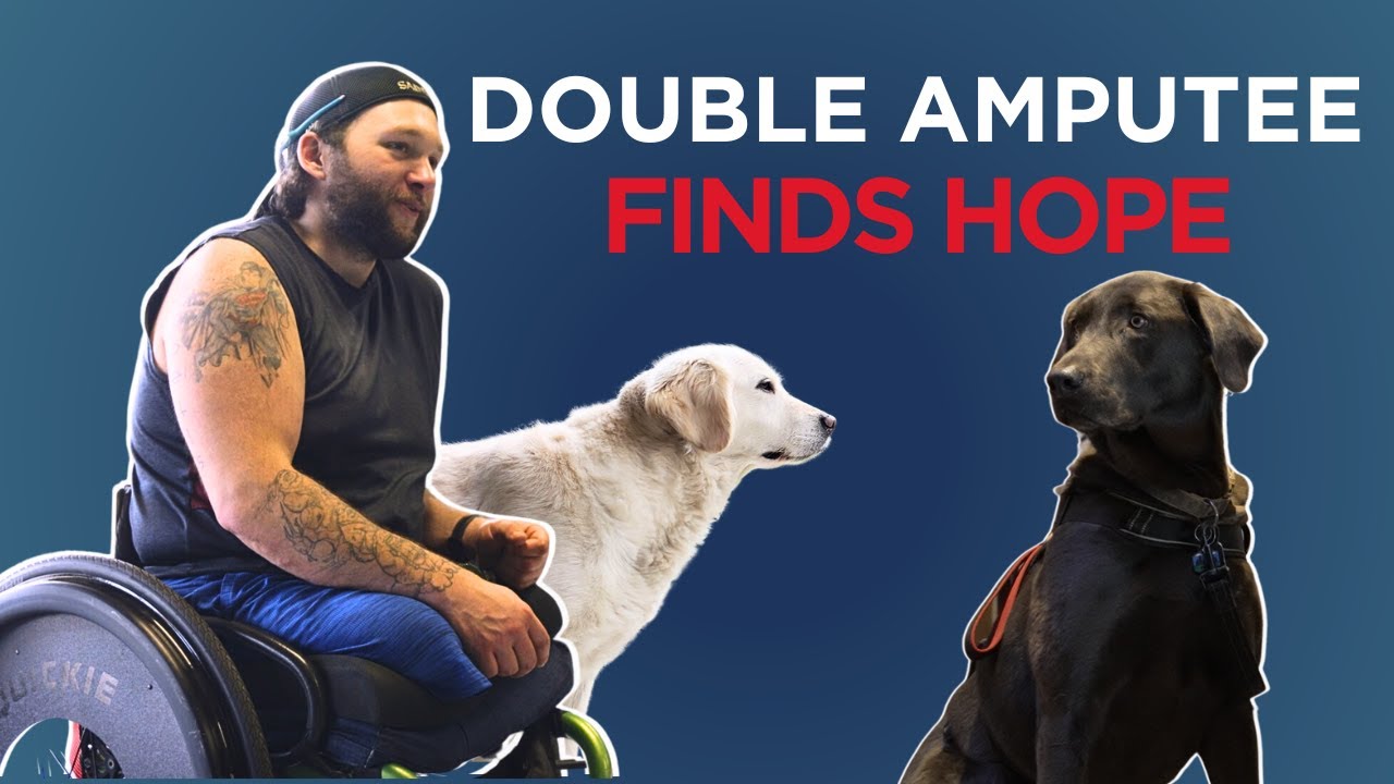 Double Amputee Finds Hope