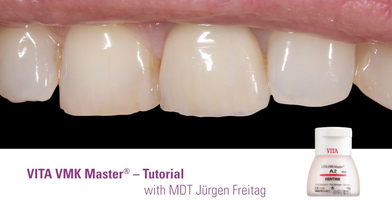 EN | VITA VMK Master® Tutorial | Step-by-Step with Jürgen Freitag