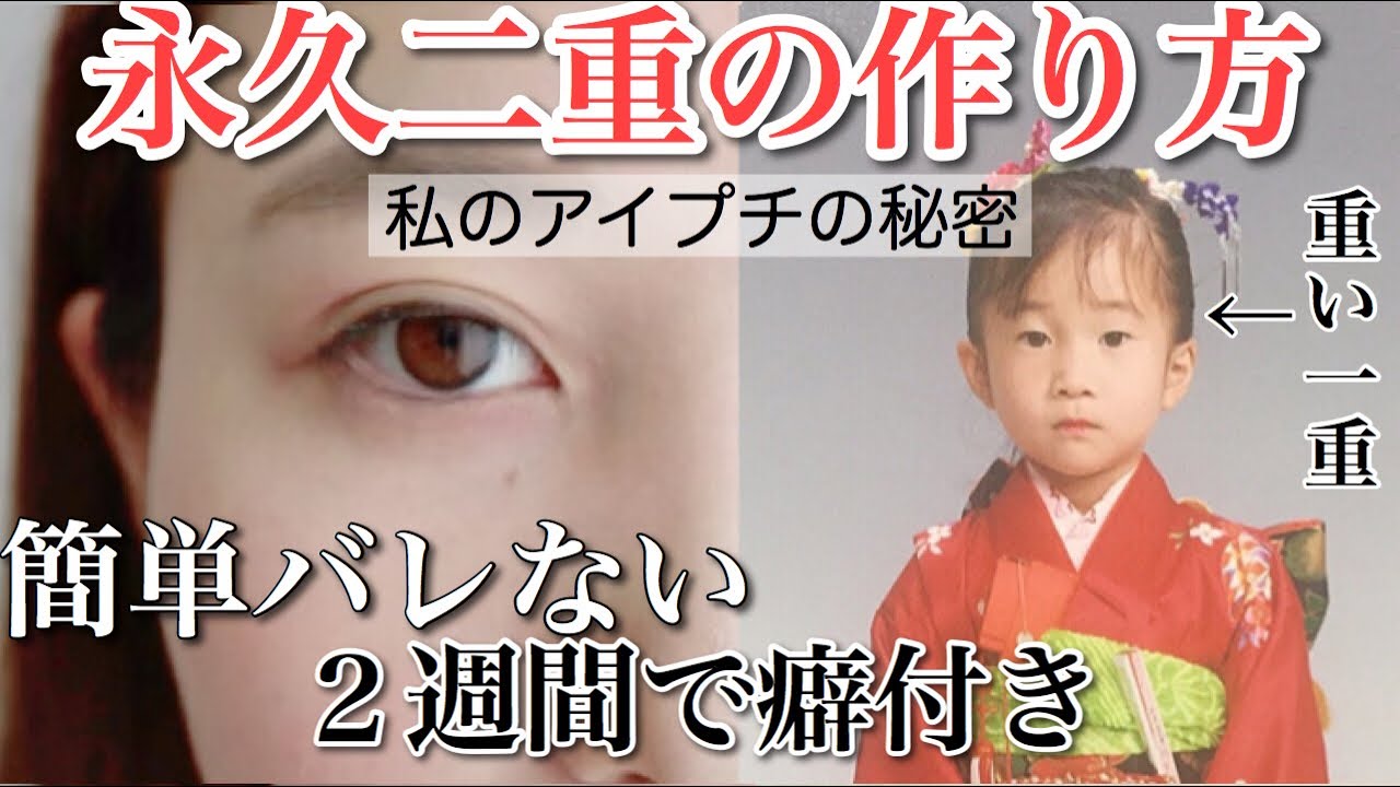 【必見】激重一重の私が2週間で平行二重瞼になった方法【簡単】