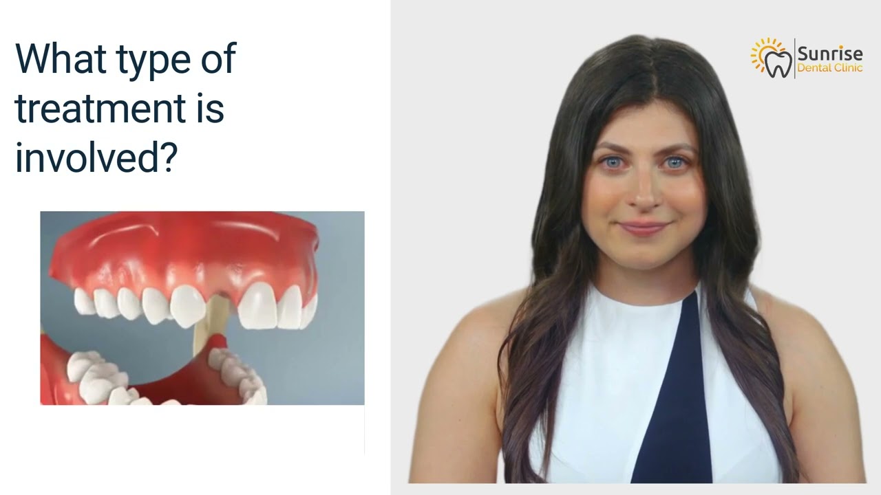 Hypodontia